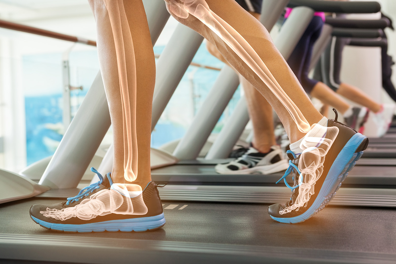 Person walking on treadmill highlighting Bone Health 